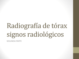 Radiografía de tórax signos radiológicos