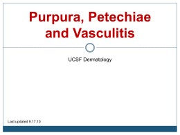 Purpura, Petechiae and Vasculitis