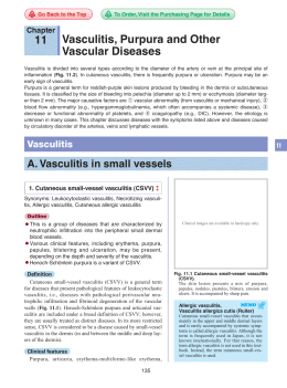11 Vasculitis, Purpura and Other Vascular Diseases