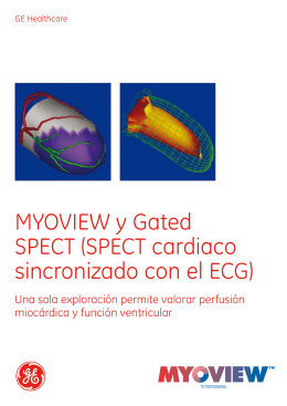 MYOVIEW y Gated SPECT (SPECT cardiaco sincronizado con el