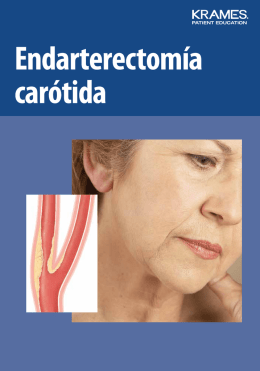 Endarterectomía carótida