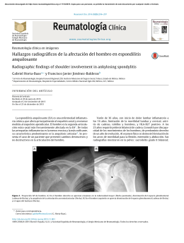Hallazgos radiográficos de la afectación del hombro en espondilitis