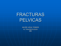 FracturasPelvicas.pps