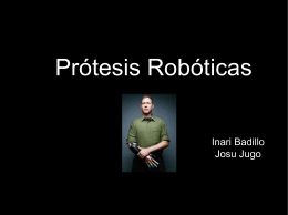 Prótesis Robóticas