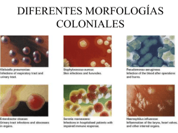 DIFERENTES MORFOLOGÍAS COLONIALES