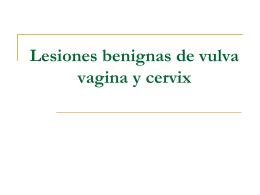 Lesiones benignas de vulva vagina y cervix