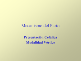 Parto_Modalidad_Vertice_ppt.