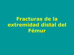 02 - Fractura del Extremo Distal del Fémur - lerat