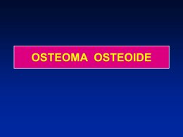 02- Osteoma osteoide - lerat
