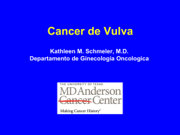 Cancer de Vulva - MD Anderson Cancer Center