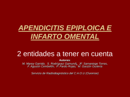 APENDICITIS EPIPLOICA E INFARTO OMENTAL
