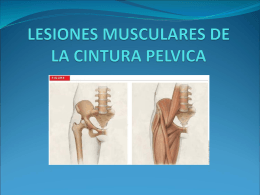 lesiones musculares de la cintura pelvica