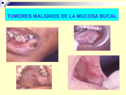 Clasificación tumores malignos.