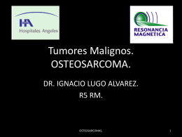 Tumores Malignos.