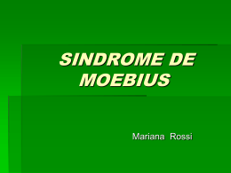 SINDROME DE MOEBIUS