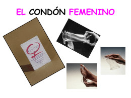 EL CONDÓN FEMENINO
