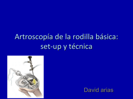 Artroscopía de la rodilla básica: set-up y técnica