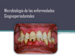 Microbiología de las enfermedades Gingivoperiodontales
