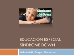 Educación Especial Síndrome Down
