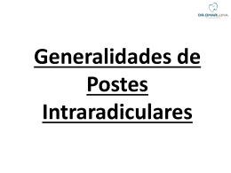 Generalidades de Postes Intraradiculares