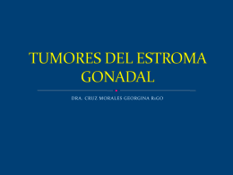 TUMORES DEL ESTROMA GONADAL