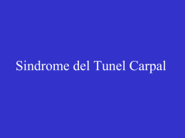 Sindrome del Tunel Carpal