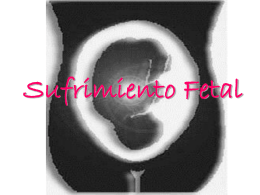 Sufrimiento Fetal - .:: MICROREDES DE SALUD -