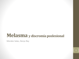 Melasma y discromía postlesional -