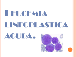 Leucemia linfoblastica