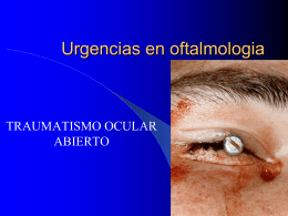 Urgencias en oftalmologia - Trasplante de cornea |