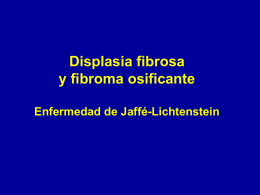 Displasia fibrosa - lerat
