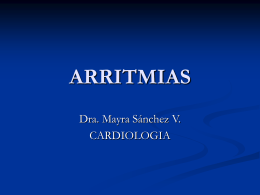ARRITMIAS - ELECTROCARDIOGRAFIA