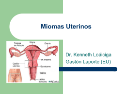 Miomas Uterinos - .:: Dr. Kenneth Loaiciga