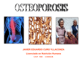 FISIOPATOLOGIA DE LA OSTEOPOROSIS