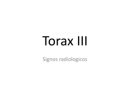 Torax III - eTableros