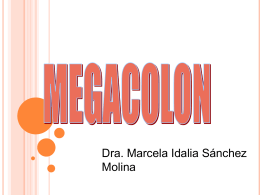 MEGACOLON