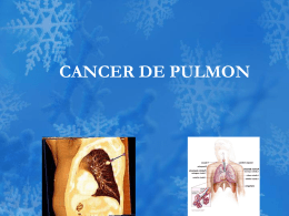 CANCER DE PULMON