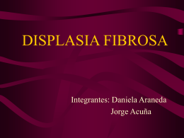 Displasia Fibrosa Monostotica
