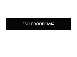 ESCLERODERMIA - ::.. Aula-MIR