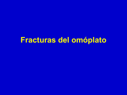 Fractures de l’omoplate - lerat