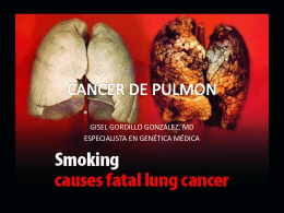 CANCER DE PULMON