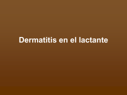 Dermatitis en el lactante