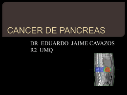CANCER DE PANCREAS