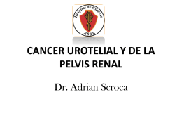 CANCER UROTELIAL Y DE LA PELVIS RENAL