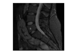 Diapositiva 1