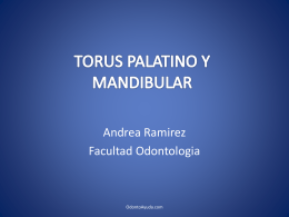 TORUS PALATINO Y MANDIBULAR