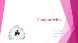Conjuntivitis