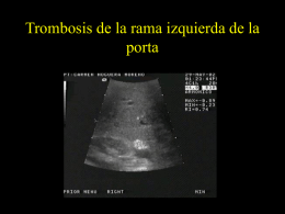 Trombosis de la rama derecha de la porta