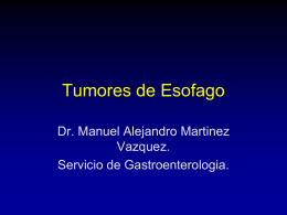 Tumores-de-Esofago