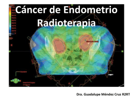 Cáncer de Endometrio Radioterapia